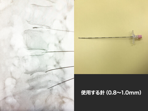当院の医療材料