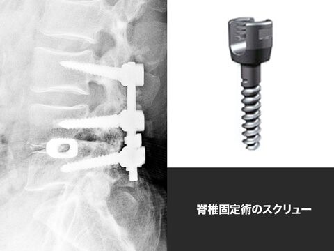 従来の医療材料