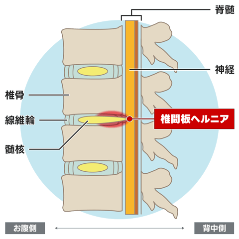 椎間板(側面図)