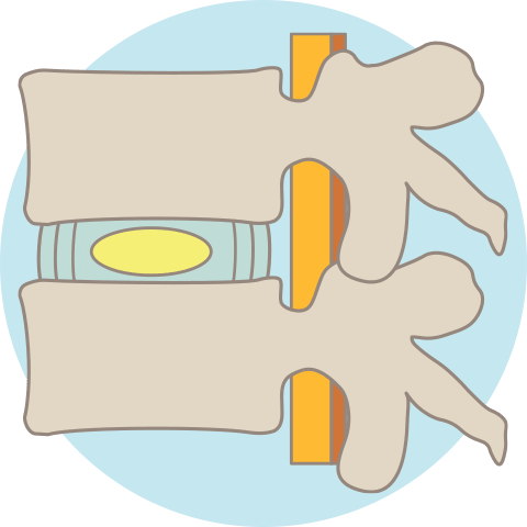 頚椎症のメカニズム：正常な椎間板