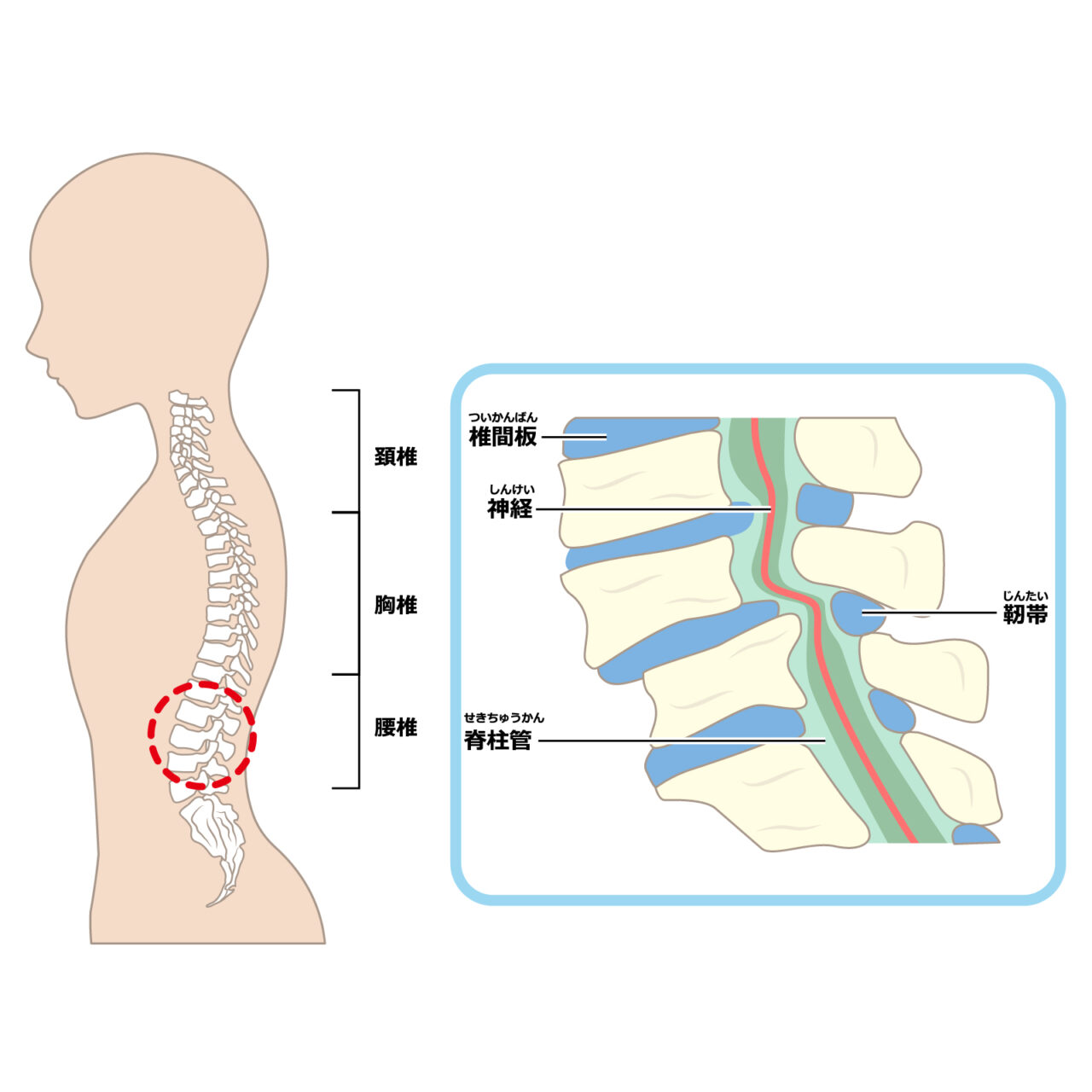 脊柱管狭窄症の説明