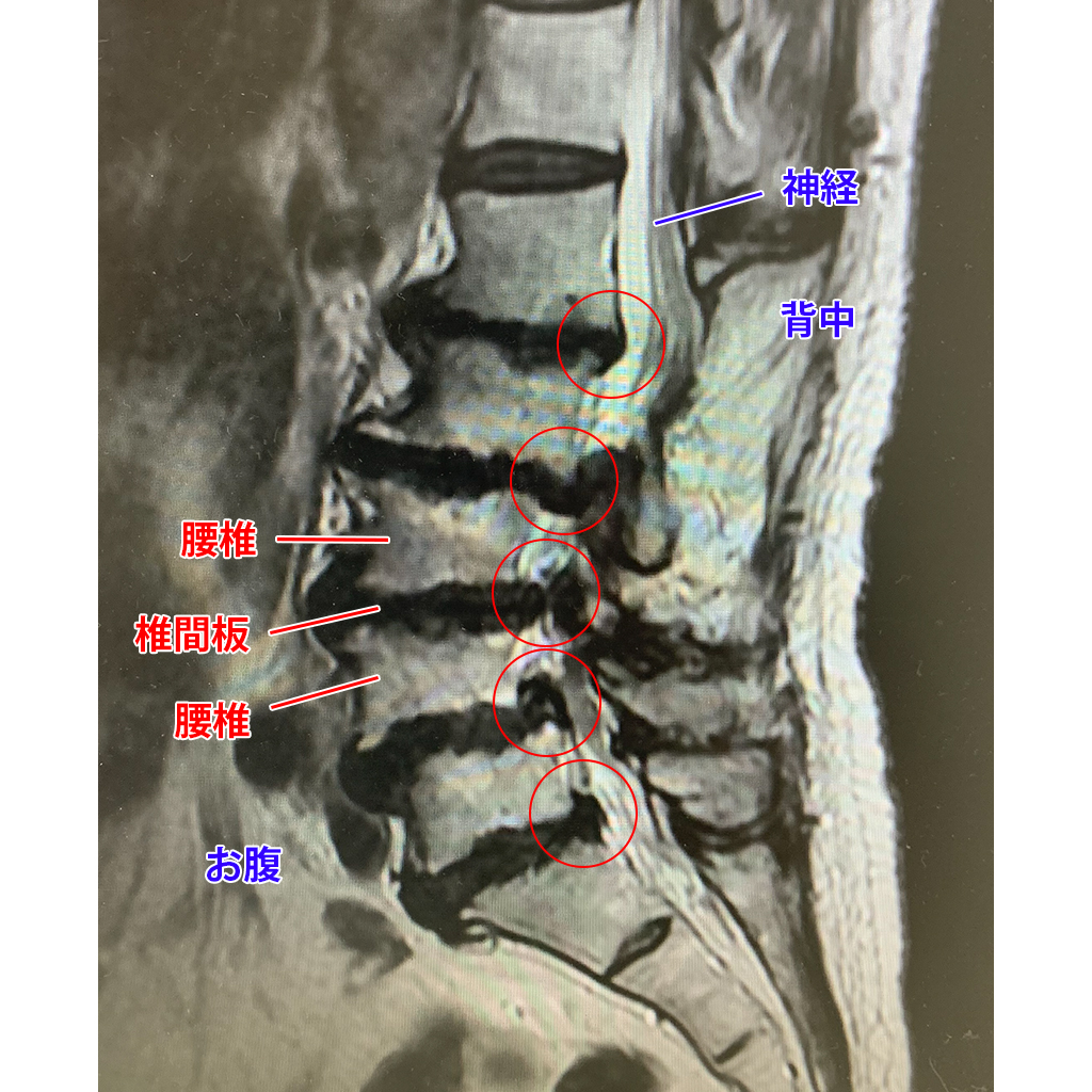 MRI