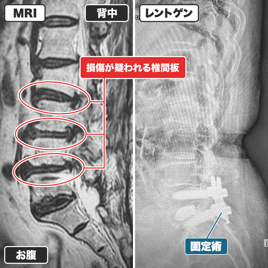MRIとレントゲン