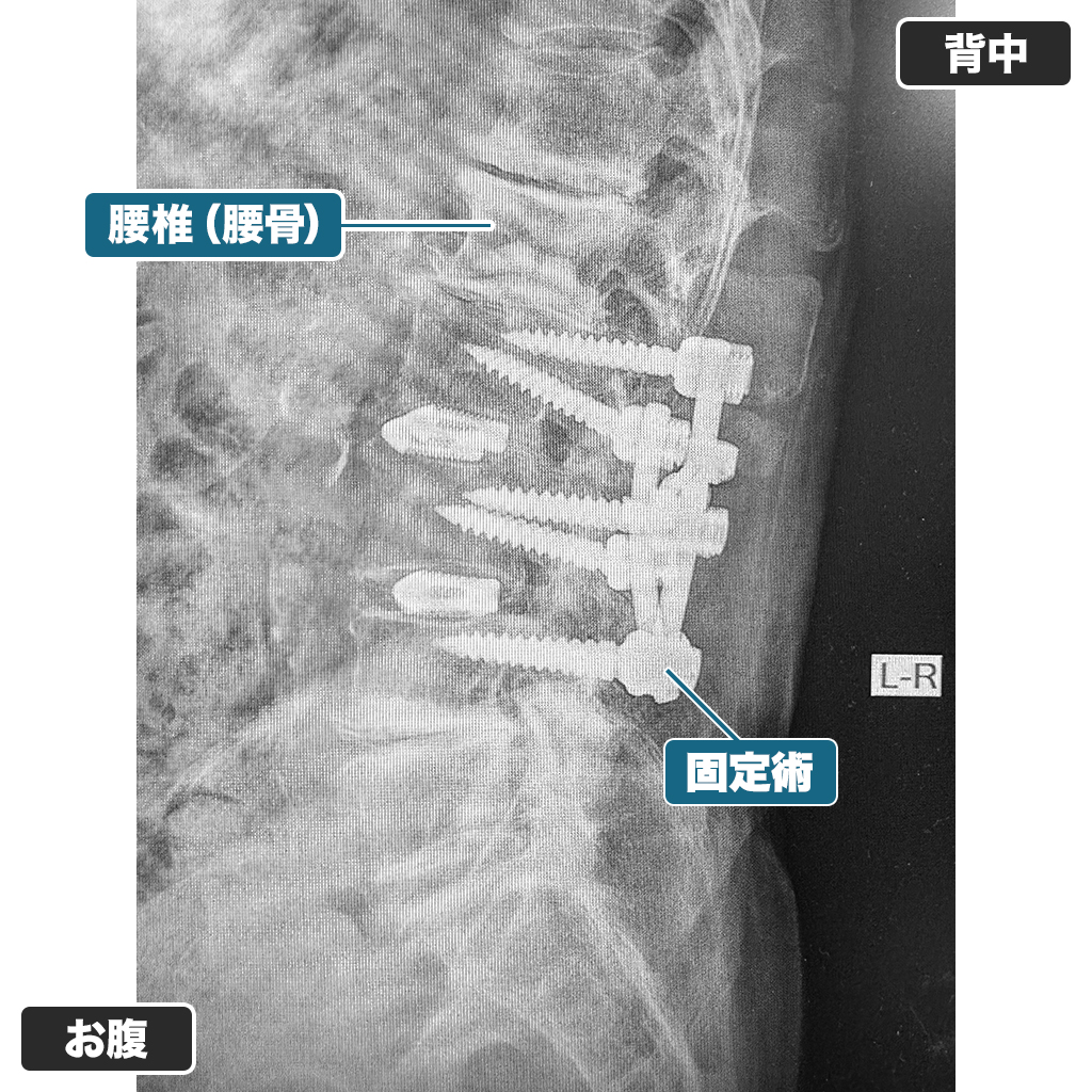 レントゲン