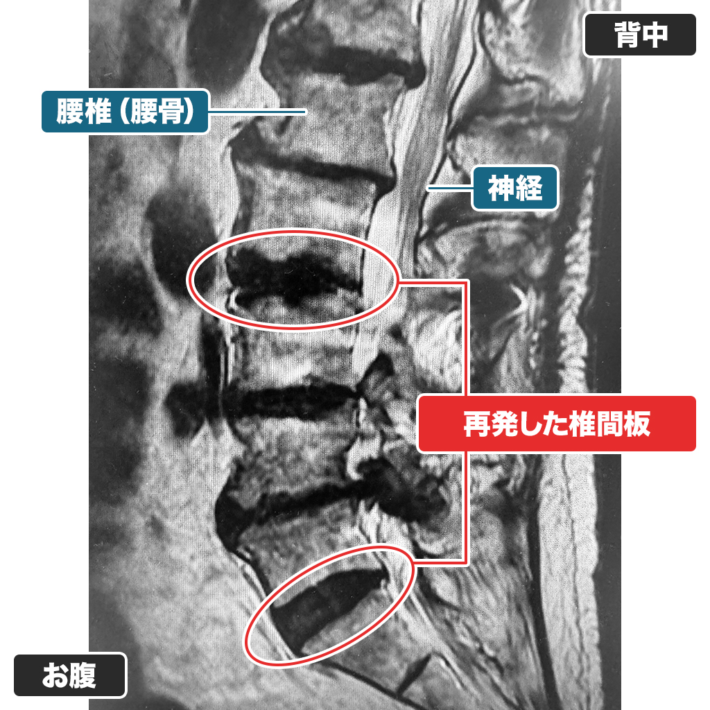 MRI