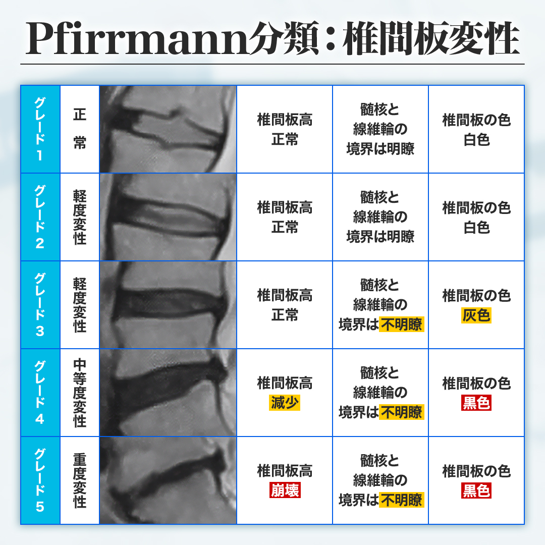 Pfirrmann分類