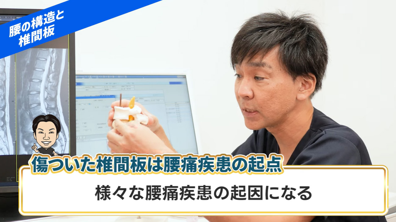 傷ついた椎間板は腰痛疾患の起点