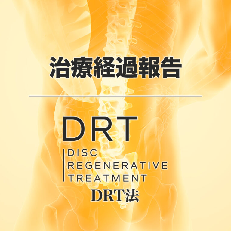 DRT法（椎間板再生治療）で6割の改善。その後……