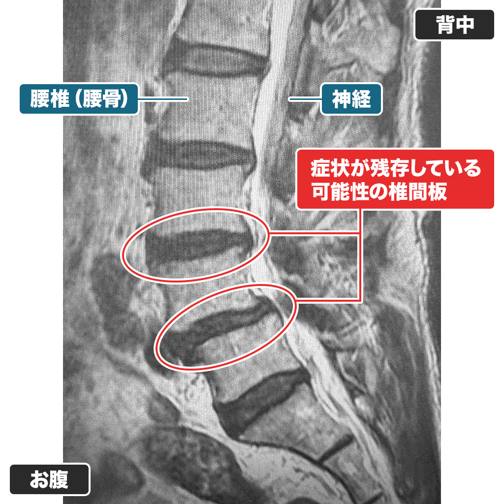 MRI