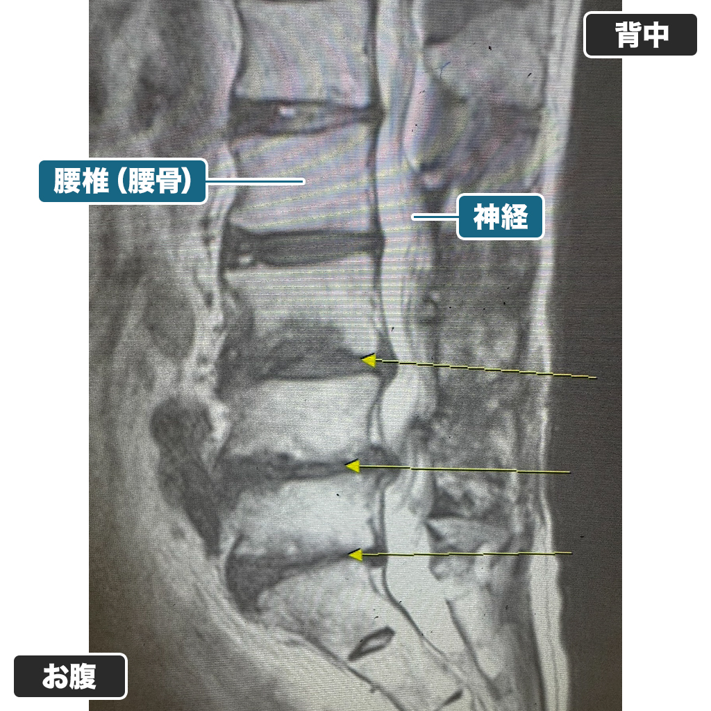 診察時のMRI