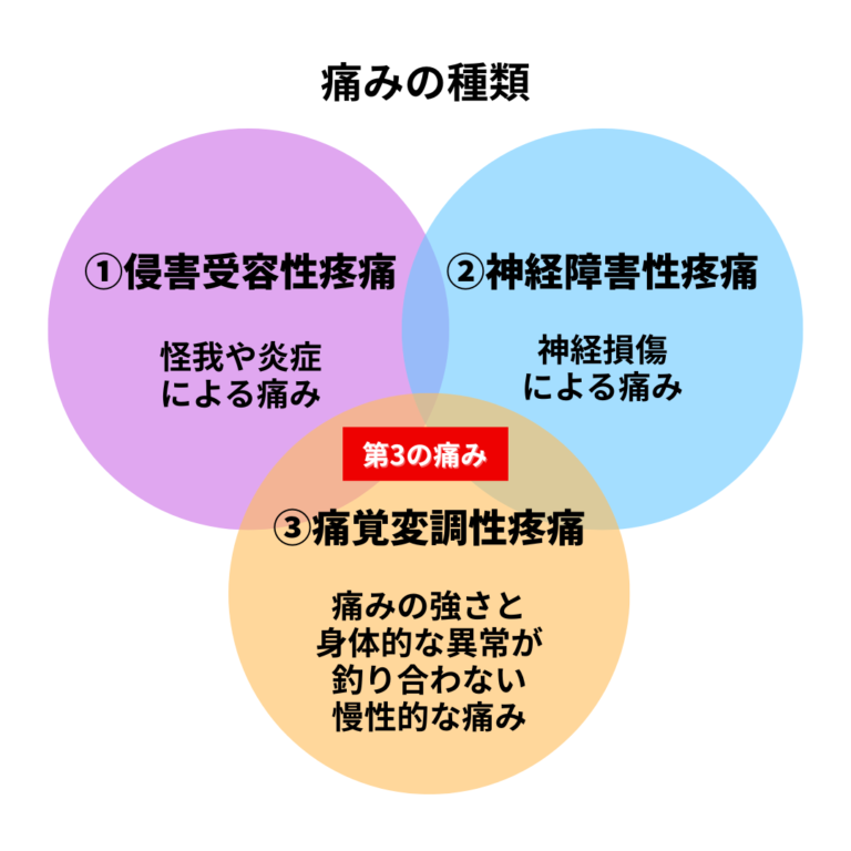 【第2回】第3の痛み「痛覚変調性疼痛」とは？