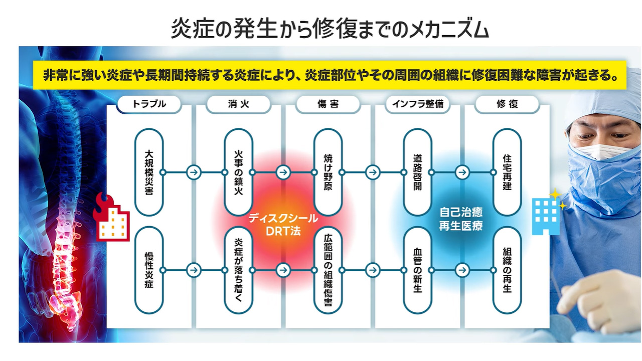 炎症の発生から修復までのメカニズム