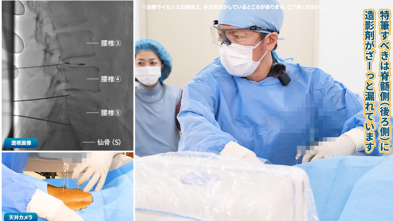 造影検査
