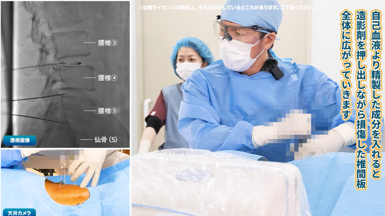 治療