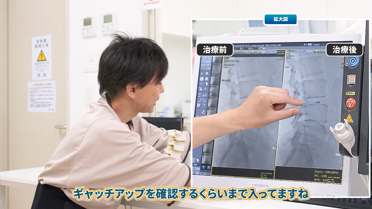 治療後の様子