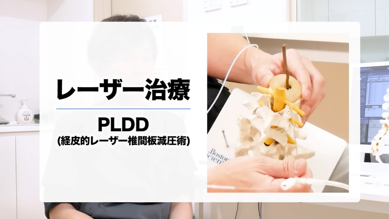 レーザー治療への挑戦