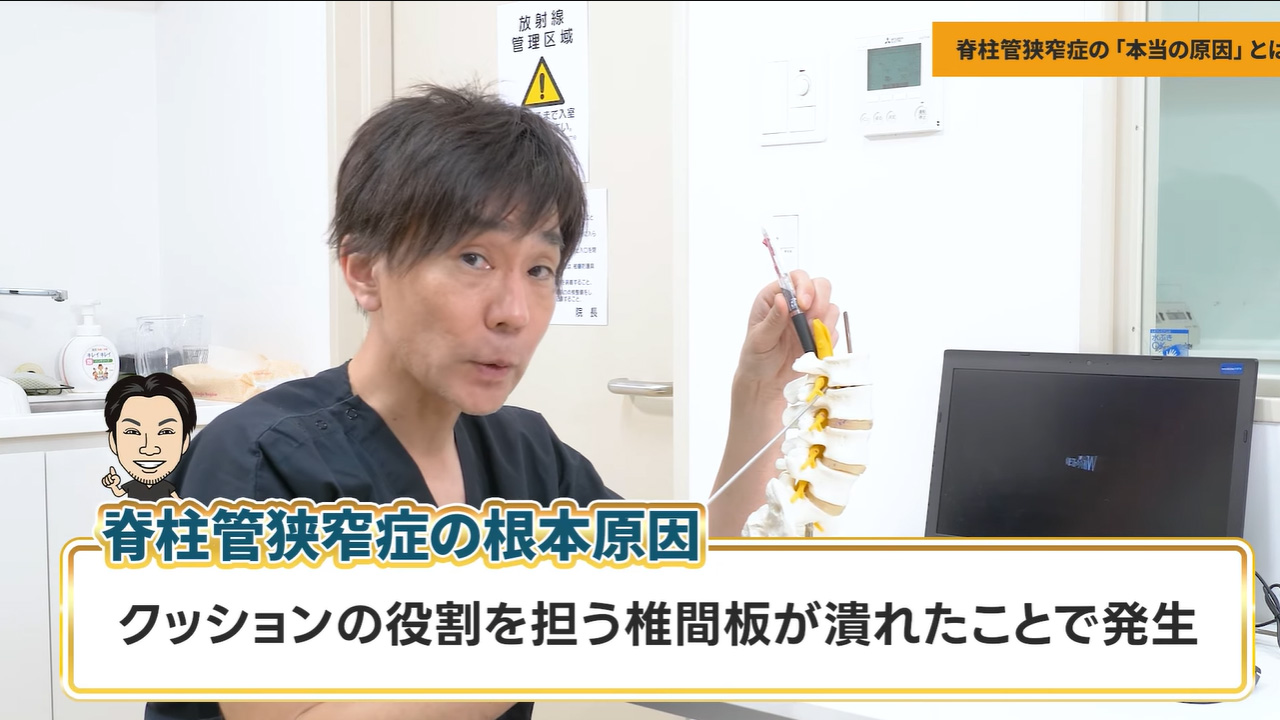 脊柱管狭窄症の根本原因
