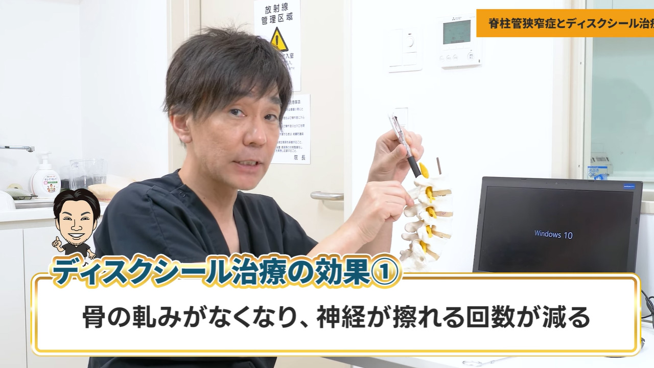 脊柱管狭窄症の効果①
