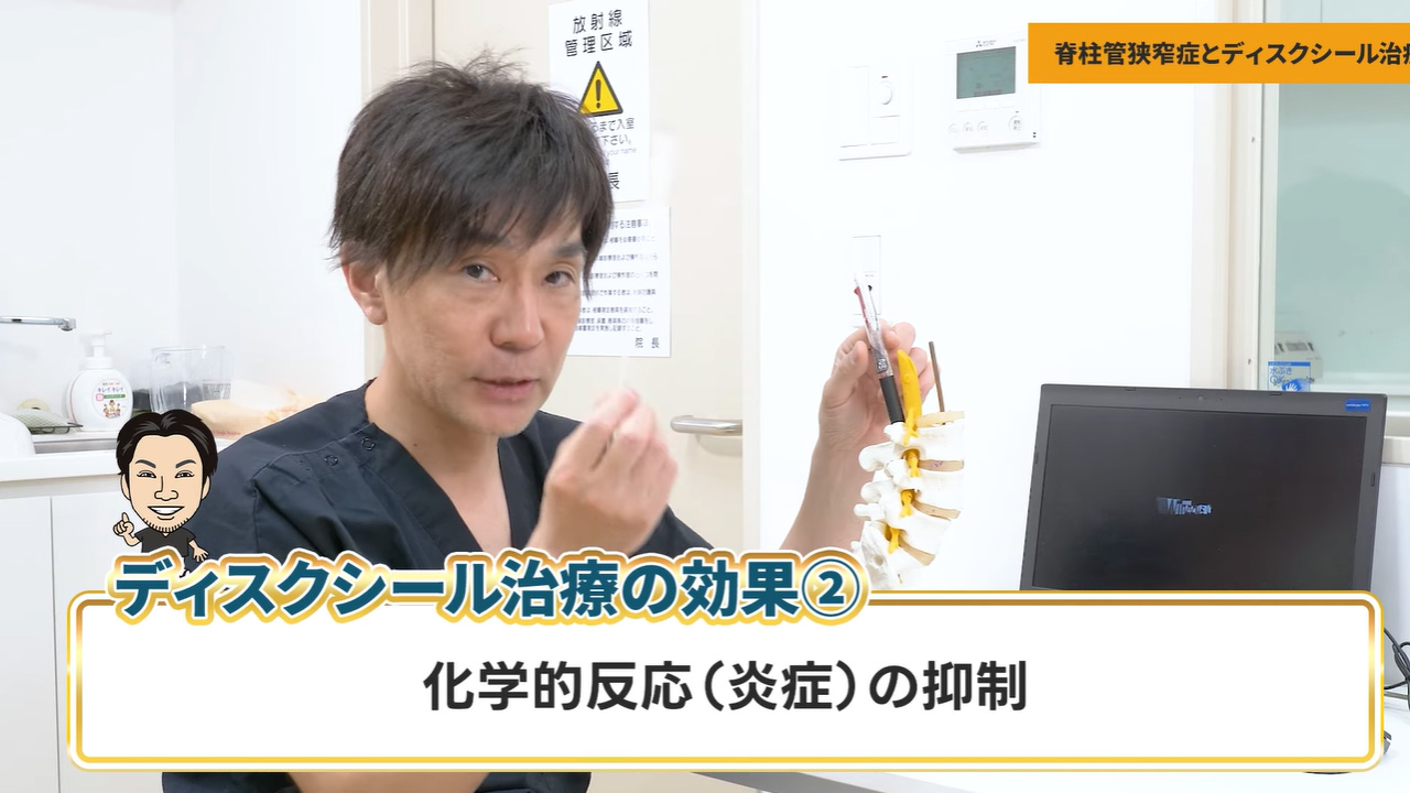 脊柱管狭窄症の効果②