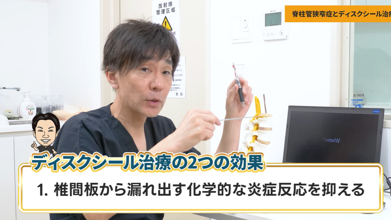 ディスクシール治療の2つの効果1