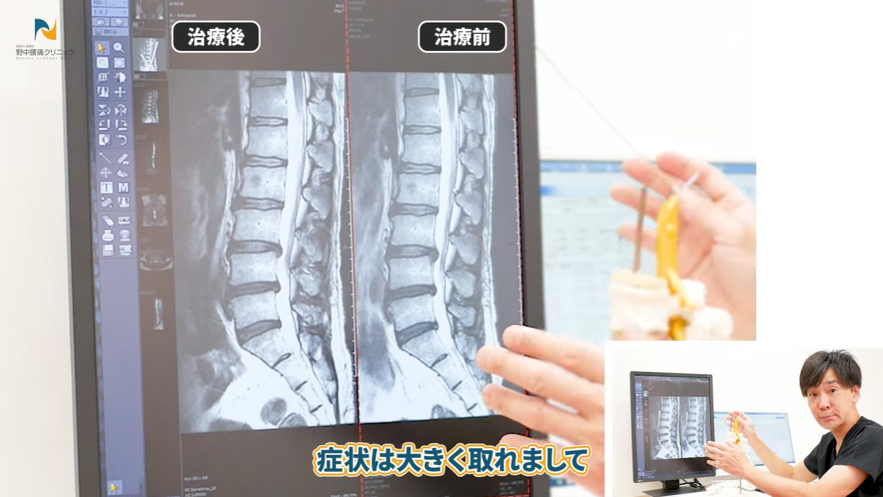 治療後良好