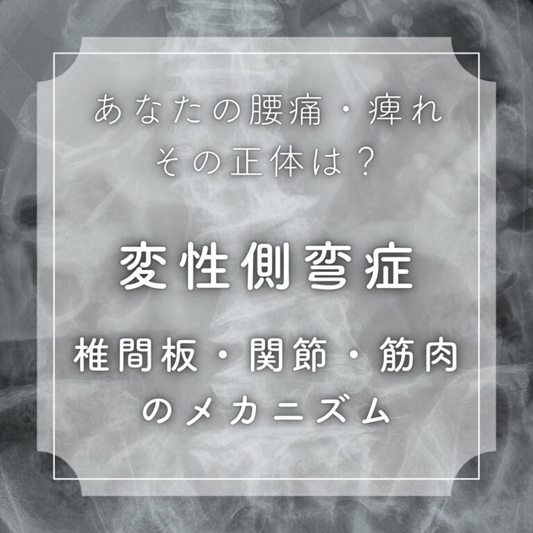 【変性側弯症】あなたの腰痛・足のしびれ、その正体は？ 椎間板、椎間関節、筋肉のメカニズムを解明