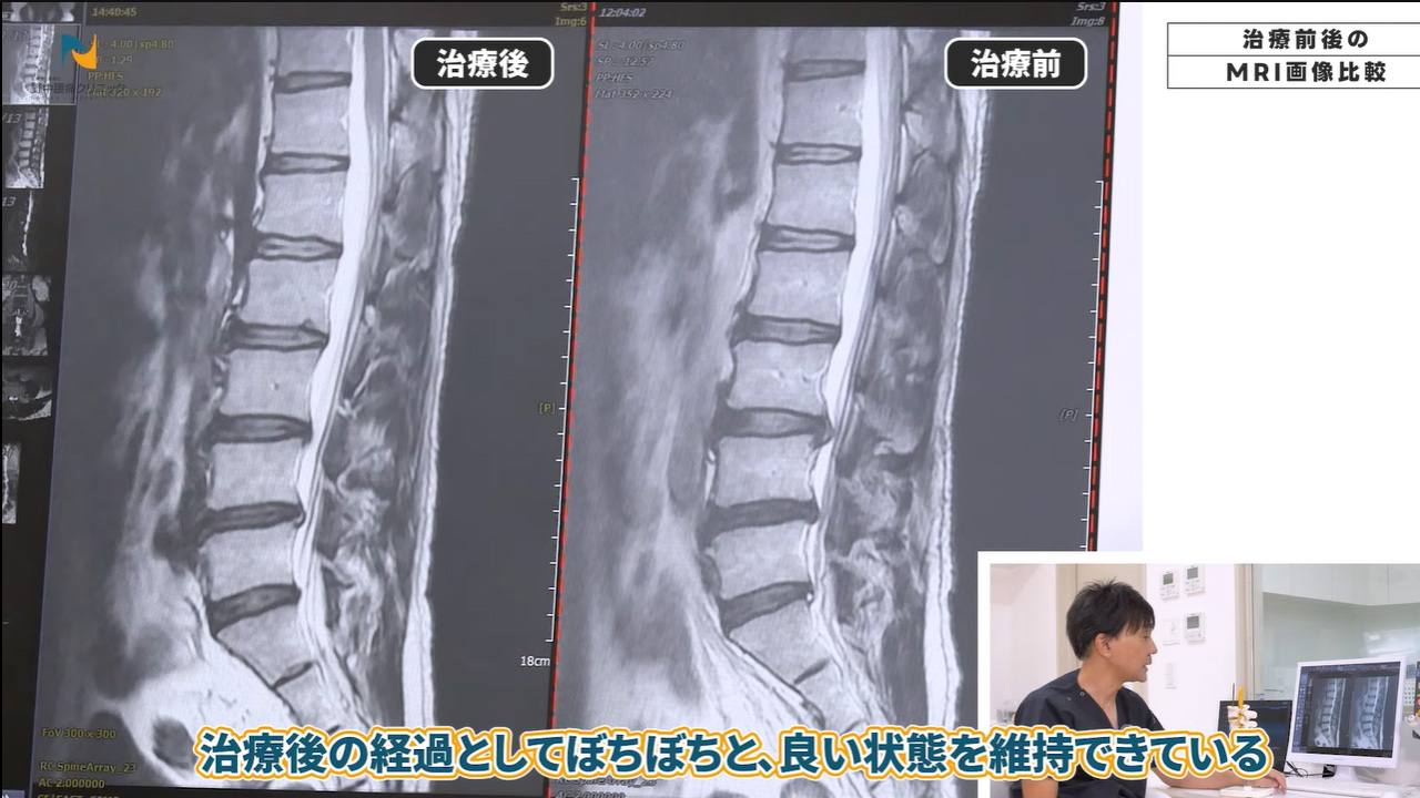 治療後良い状態