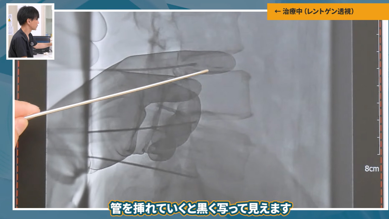 治療中の様子
