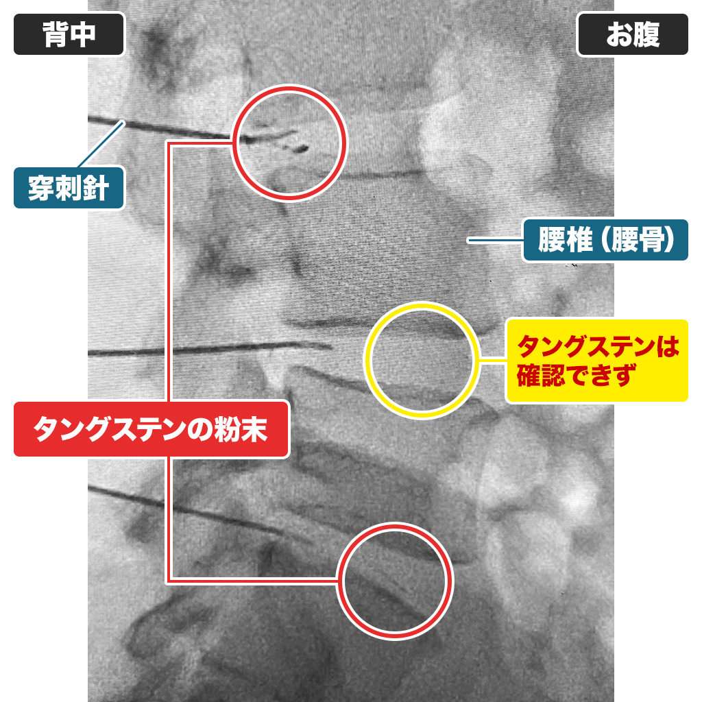 MRI