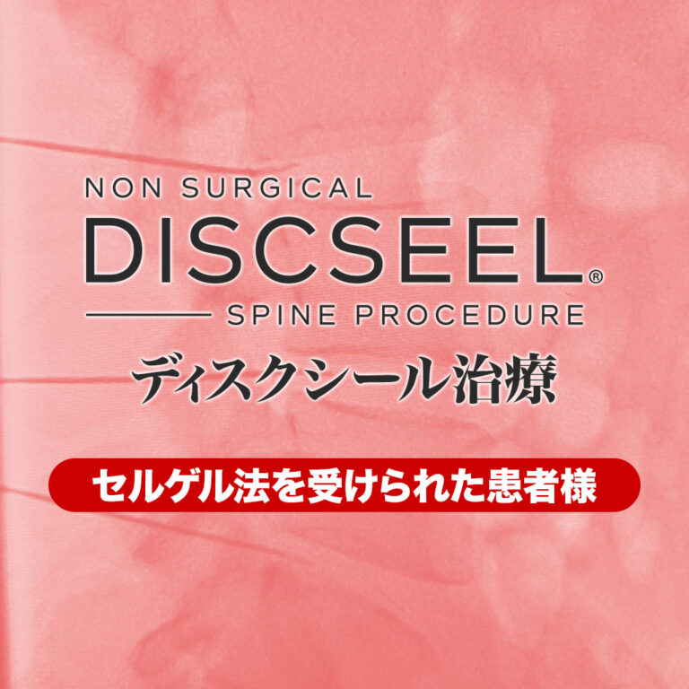 ディスコゲル（別称：セルゲル法）の治療後に再発