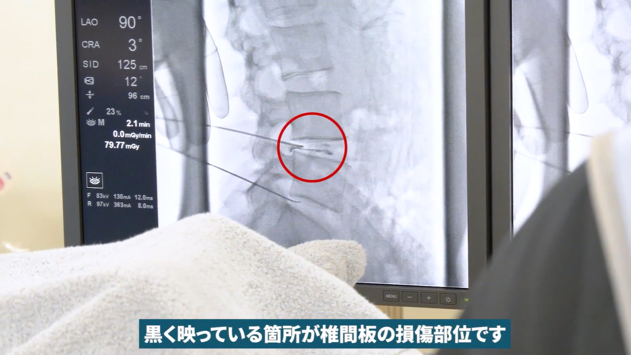 造影検査の様子