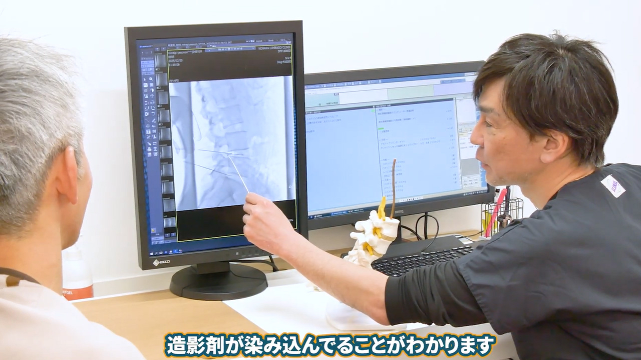 造影剤が染み込んでいる様子