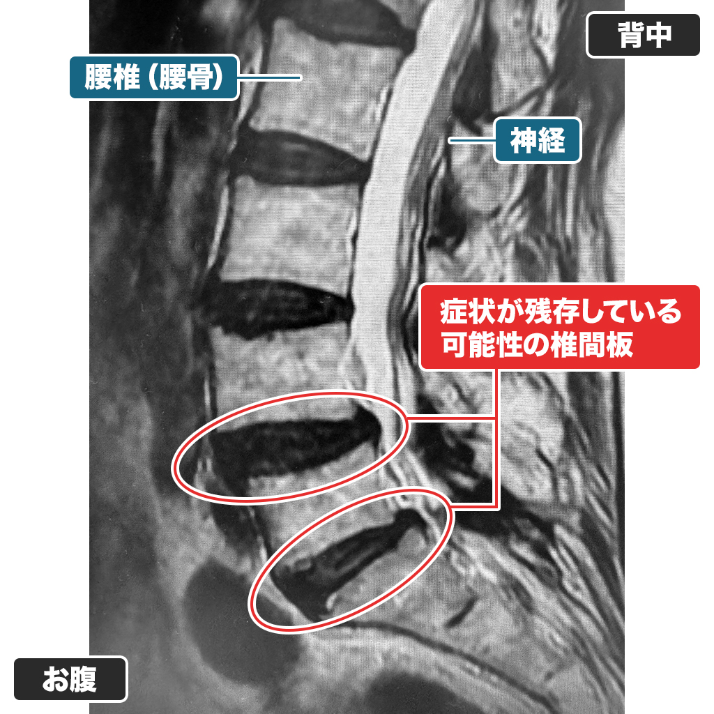 MRI