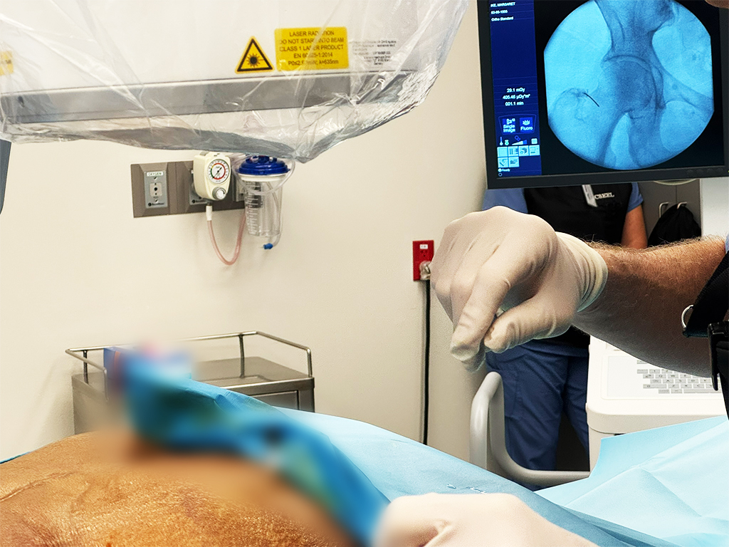 高濃度エクソソーム治療