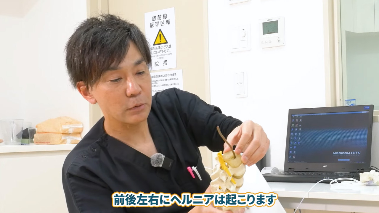 ヘルニアが起こる場所