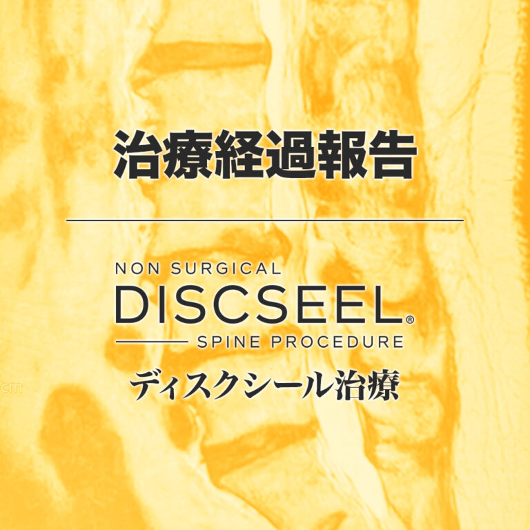 治療後2年6ヵ月経過した60代女性