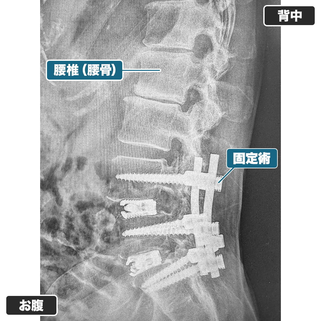 レントゲン検査