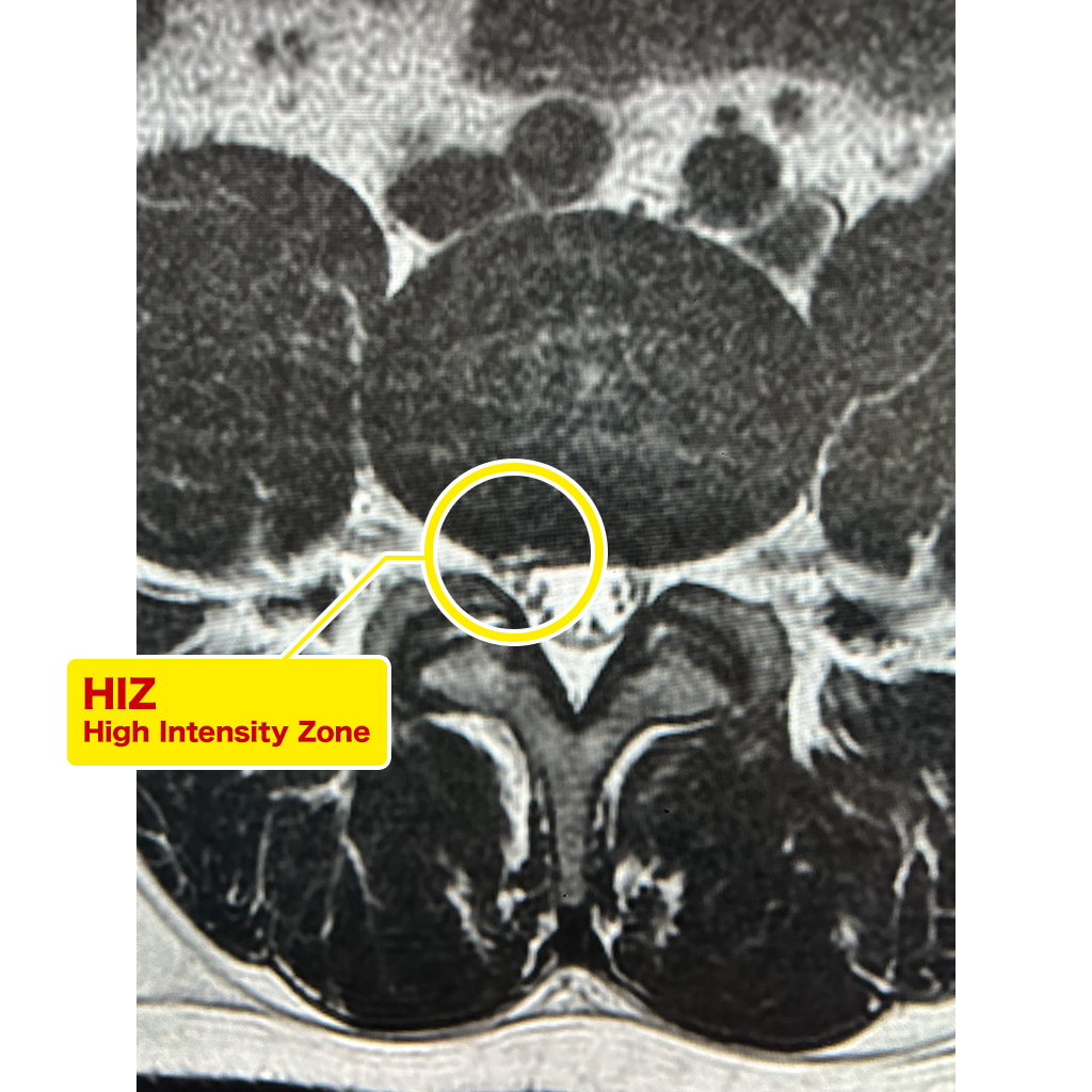 MRI検査（上部）