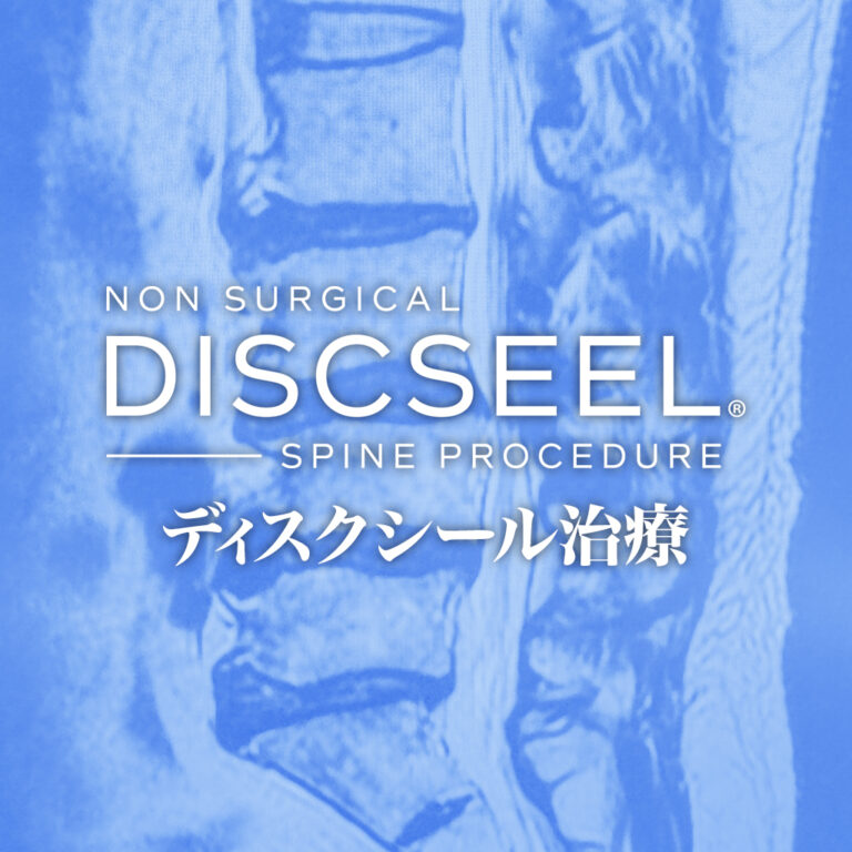 スウェーデンから来日された脊柱管狭窄症の50代女性