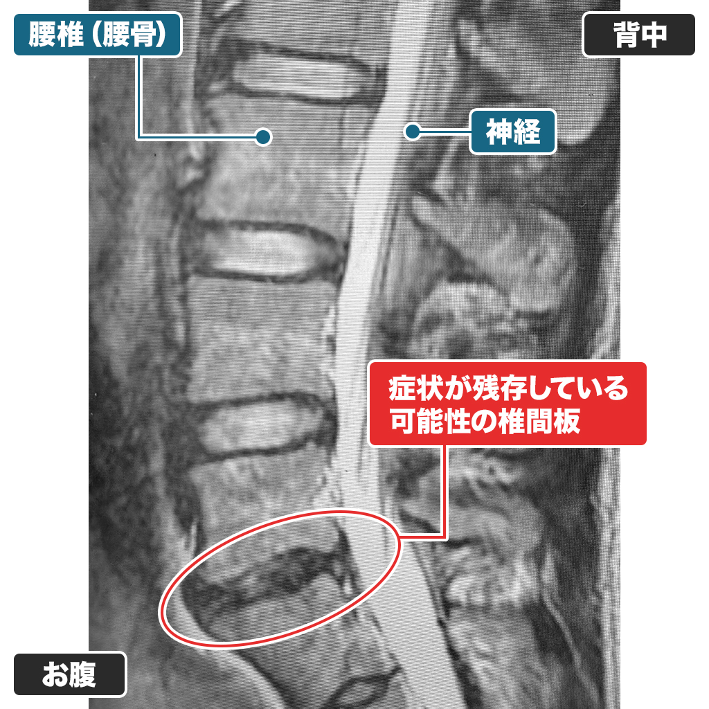 MRI：本日