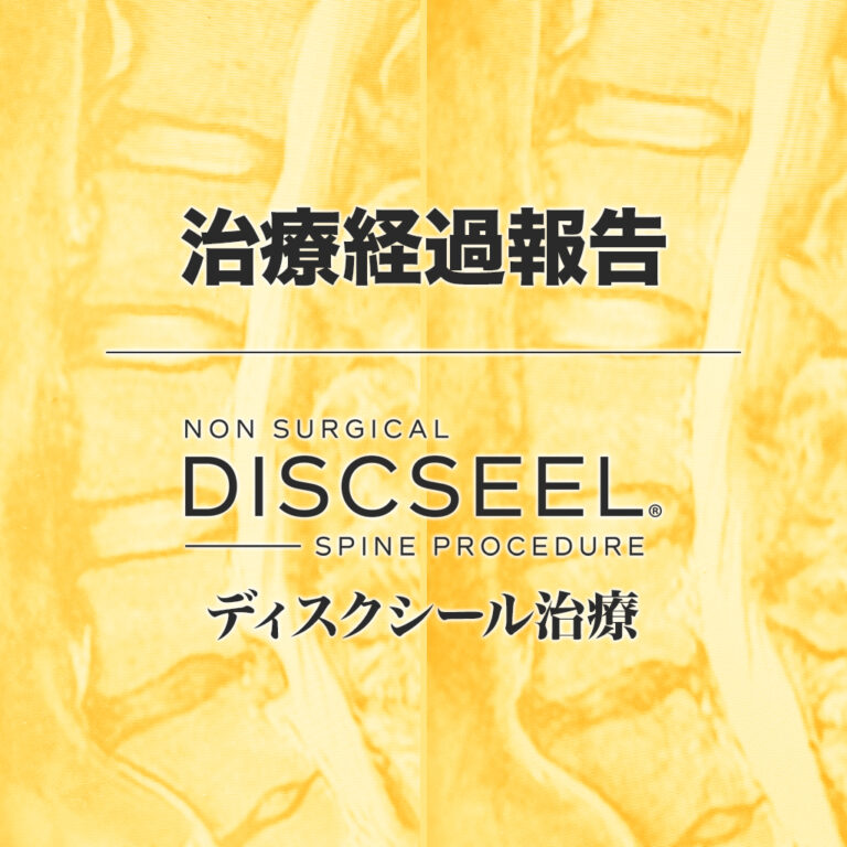 治療後7ヵ月経過しても腰痛が残存している60代男性