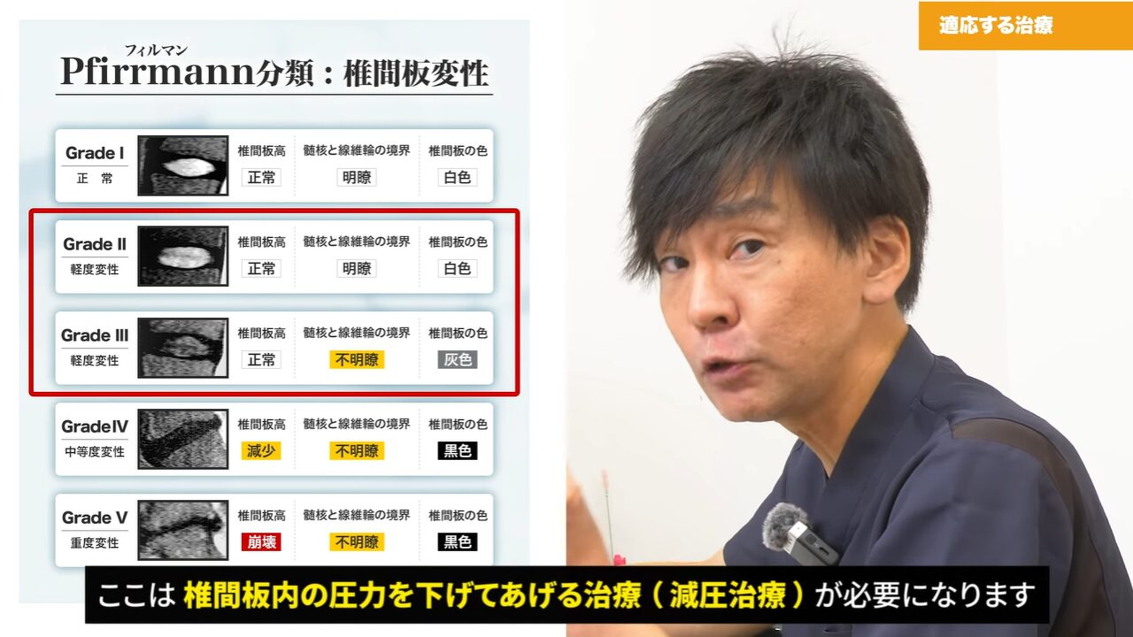 椎間板に亀裂が発生している椎間板