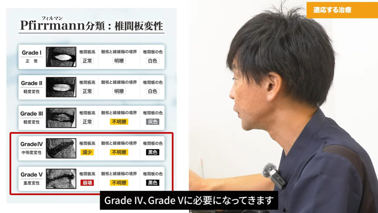 椎間板に亀裂が発生している椎間板