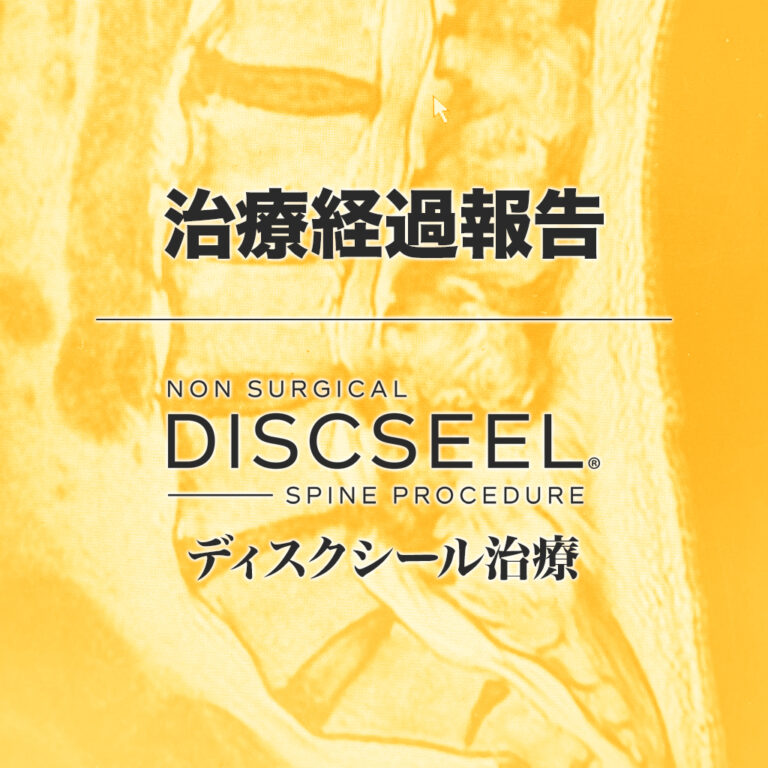 治療後4ヵ月で症状がほぼ消失した60代男性