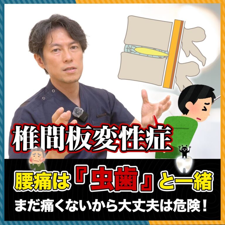 【衝撃】腰痛は「虫歯」と同じ？症状・原因と「切らずに治す」予防法