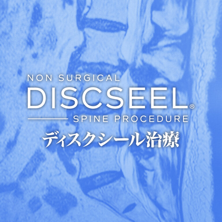 脊柱管狭窄症に対して2回目の治療(50代男性)