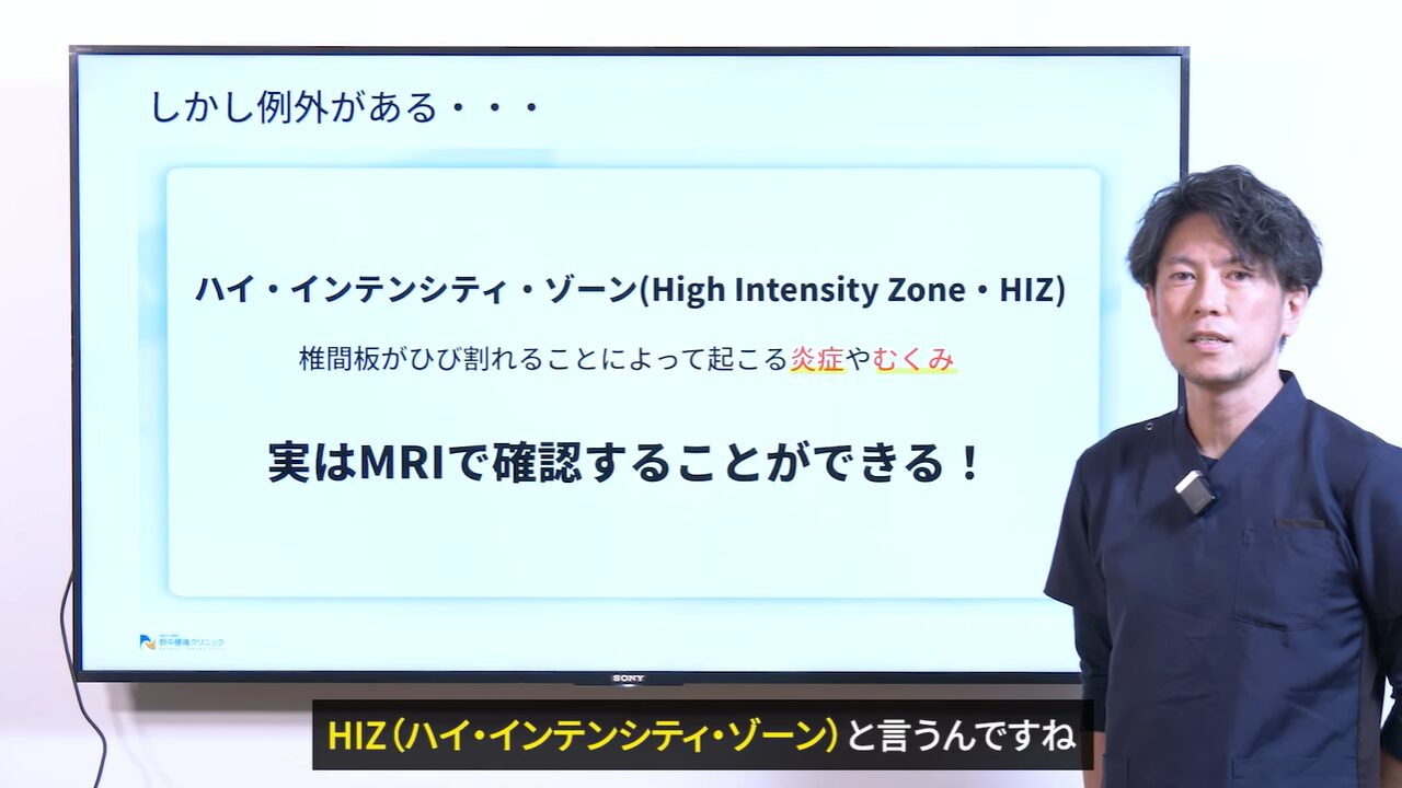 HIZはMRIで確認できる