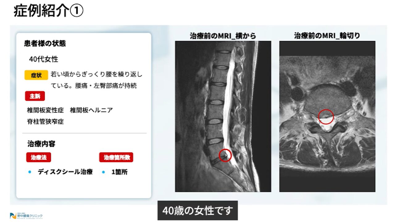 症例①治療経緯