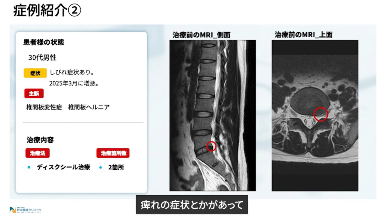 症例②治療経緯