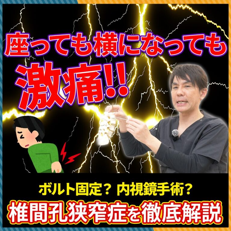 【椎間孔狭窄症】座っても横になっても痛い！その原因・症状・治療方法を徹底解説